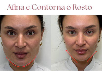 V-DermaLift – Máscara de Contorno Facial que Reduz Papada, Suaviza Rugas e Define o Rosto